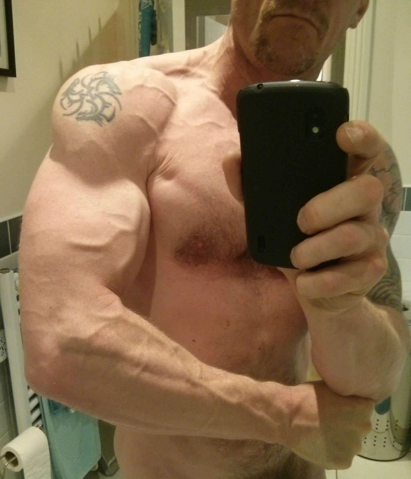 Vascularity